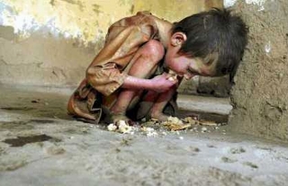Nghĩ trước khi ăn: 20.000 trẻ chết đói mỗi ngày!