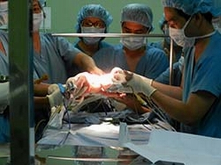 Bệnh viện Nhi Đồng 1::  Tách thành công hai cháu bé song sinh dính ngực phức tạp