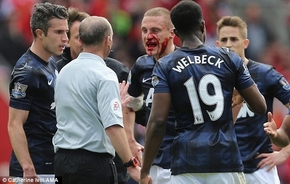 Vidic đổ máu trong ngày chia tay Man Utd