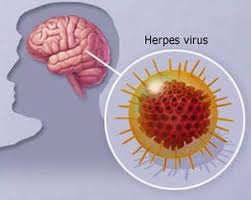 Khuyến cáo về phòng chống bệnh viêm não virus