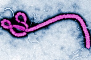 Virus gây dịch ở Congo không liên quan virus Ebola tại Tây Phi