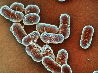 Bệnh do nhiễm khuẩn Listeria gây viêm não, sảy thai