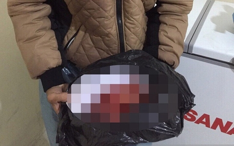 Hình ảnh đăng trên một số báo điện tử với thông tin tìm được xác thai nhi vắn số tại bãi rác ở Yên Phong, Bắc Ninh (ảnh: internet)