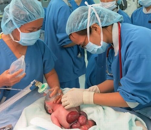 Em bé được các bác sĩ Vinmec hồi sức ngay sau khi sinh - hầu hết tạng của bé đều nằm ngoài thành bụng.