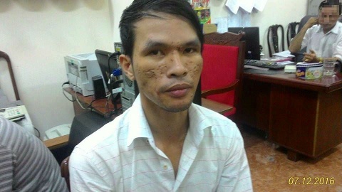 Khởi tố kẻ hành hạ dã man bé trai người Campuchia