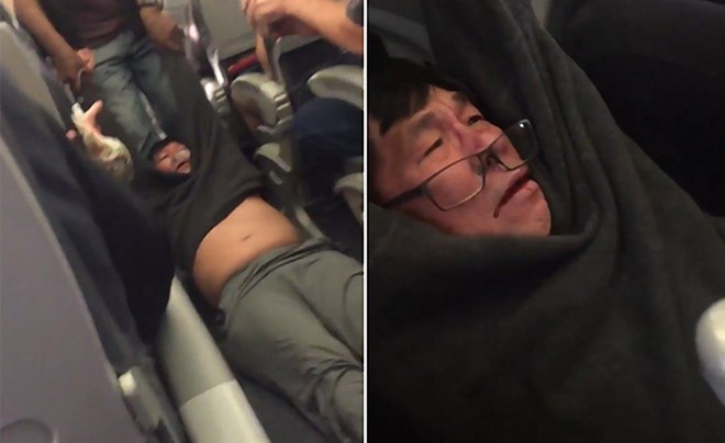 Máu chảy trên mặt bác sĩ David Dao khi ông bị kéo khỏi máy bay trước sự chứng kiến của nhiều hành khách. Ảnh: Twitter.