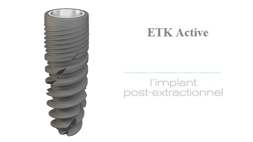 (Implant ETK Active)