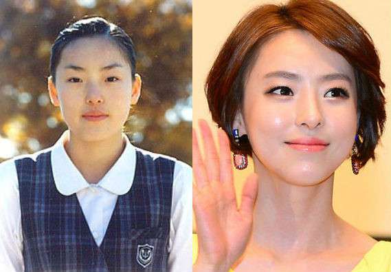 Lee Da Hee, nữ diễn viên trong phim I Hear Your Voice cũng là gương mặt điển hình khi nhắc tới phẫu thuật thẩm mỹ thành công ở Hàn Quốc. Cô sở hữu gương mặt xinh đẹp, phong thái quyến rũ, lạnh lùng. Tuy nhiên, cô có được vẻ đẹp này một phần cũng nhờ phương pháp 