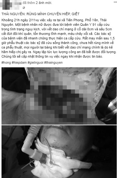 Hình ảnh chị K.A bị thương nặng ở cổ được chia sẻ trên mạng xã hội. (Ảnh chụp màn hình)