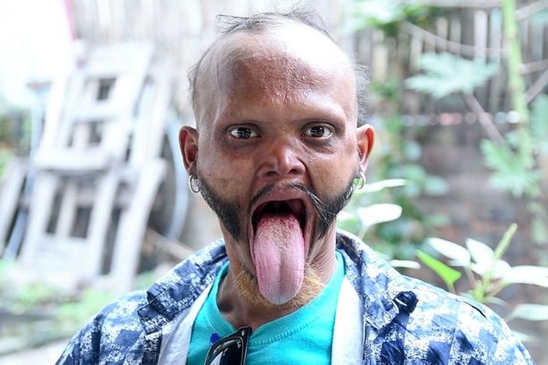 Anh Yagya Bahadur Katuwal có chiếc lưỡi rất dài. Ảnh: CATERS NEWS AGENCY