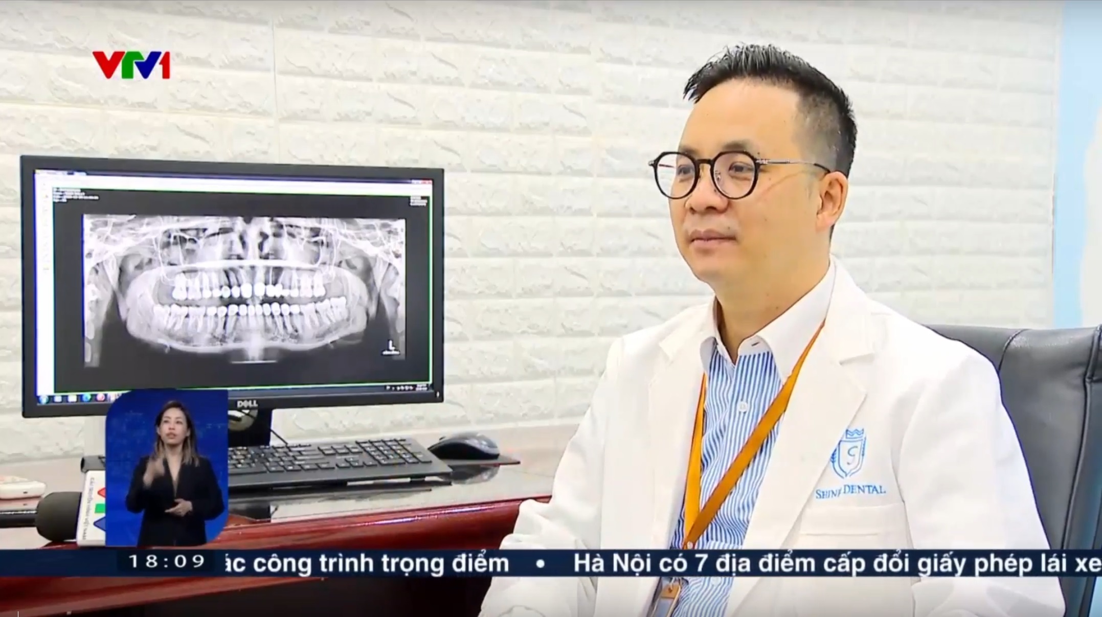 Bác sĩ Nguyễn Văn Hoà - Giám đốc chuyên môn hệ thống Nha khoa Shinbi cho biết đã phải xử lý nhiều trường hợp liên quan tới răng sứ thẩm mỹ