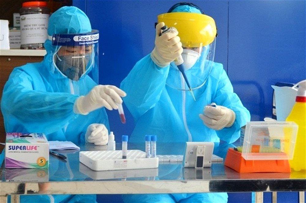 xét nghiệm covid
