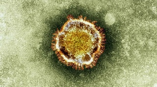 Thêm một bệnh nhân tử vong do virus mới giống SARS