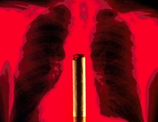 Gần 100% bệnh nhân ung thư phổi có hút thuốc lá