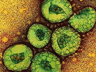 Pháp:: Xác nhận ca đầu tiên nhiễm virus giống SARS