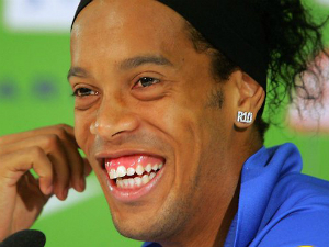 Đi thẩm mỹ, Ronaldinho hết biệt danh &quot;Rô vẩu&quot;