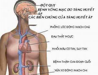 Rất nhiều người Việt hiểu sai về bệnh tăng huyết áp