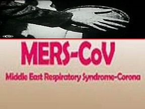 Lại thêm một trường hợp tử vong do MERS-CoV