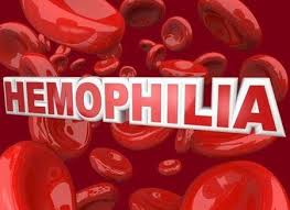 Hemophilia: Rối loạn đông máu có thể gây tử vong