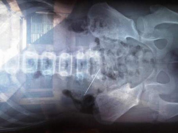 Phim X-quang cho thấy trong bụng cháu bé có chiếc kim dài khoảng 5cm.