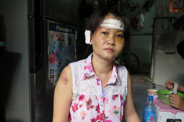 Bà Nguyễn Anh Thảo xác nhận gia đình bà bị tấn công nhiều lần bởi các đối tượng lạ