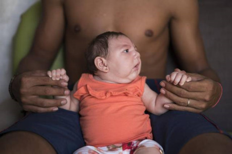 Em bé Jose Wesley bị chứng đầu nhỏ vì mẹ em bị nhiễm virus Zika trong thời gian mang bầu đang tắm tại nhà ở Poco Fundo, bang Pernambuco, Brazil - Ảnh: AP