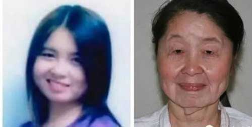 Gương mặt Hu Juan trước và sau khi chịu hậu quả của mỹ phẩm giả