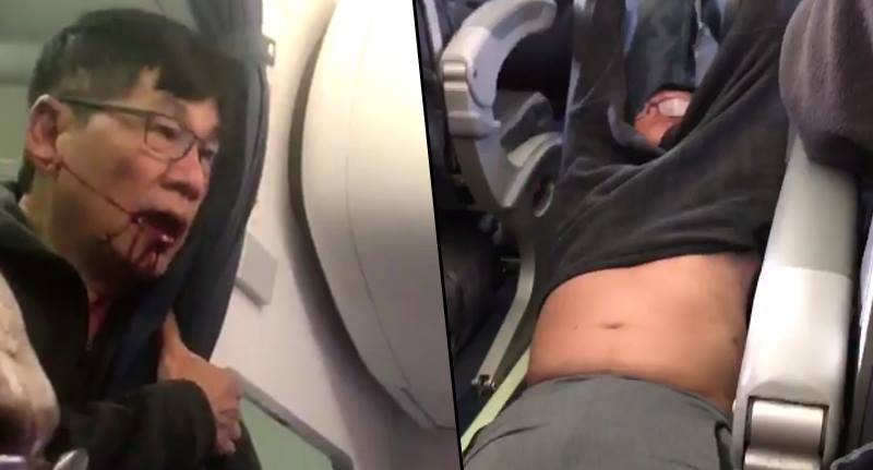 Hình ảnh bác sĩ David Dao bị lôi khỏi máy bay với khuôn mặt dính máu (ảnh cắt từ video)