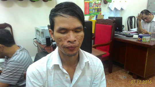 Truy tố bị can hành hạ bé trai 2 tuổi tại Campuchia