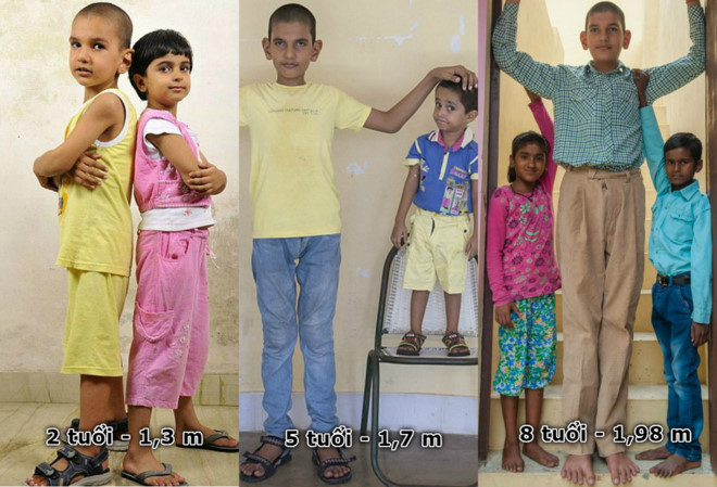 Từ trẻ sơ sinh nặng nhất thế giới đến cậu bé 8 tuổi cao 1,98 m