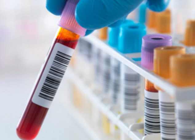 Kết quả xét nghiệm cho thấy số lượng virus HIV trong máu của bệnh nhi từ mức 