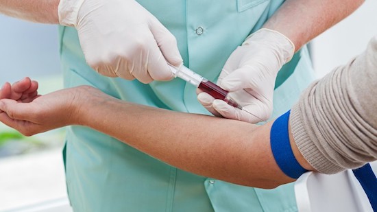 Sốt xuất huyết: Không cần nhập viện ngay nhưng phải xét nghiệm máu hàng ngày