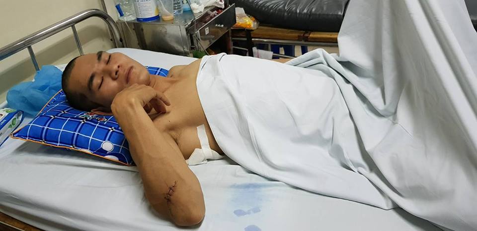 Anh May đang được điều trị tại bệnh viện Việt Đức, Hà Nội