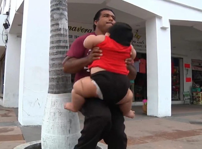 Cha của bé Luis bế con có trọng lượng cơ thể bằng đứa trẻ 9 tuổi. Ảnh: 